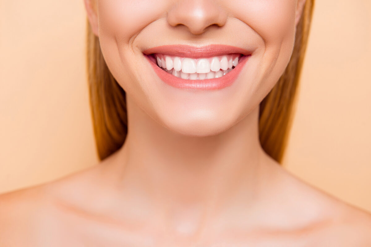 gummy smile correction Roseville