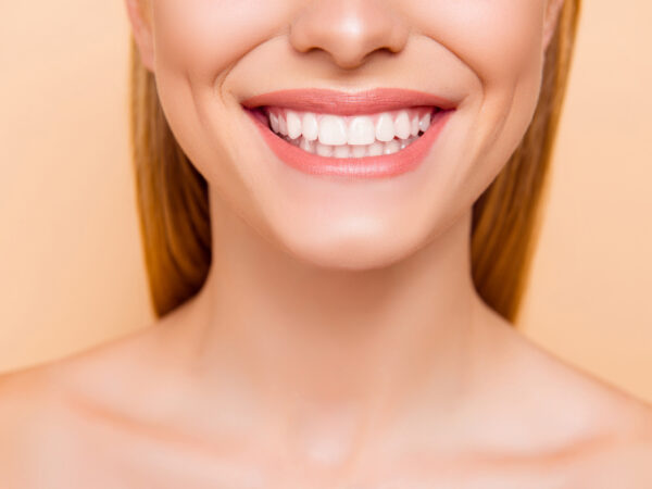 gummy smile correction Roseville