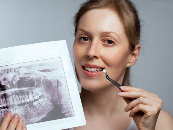dental crowns in roseville ca